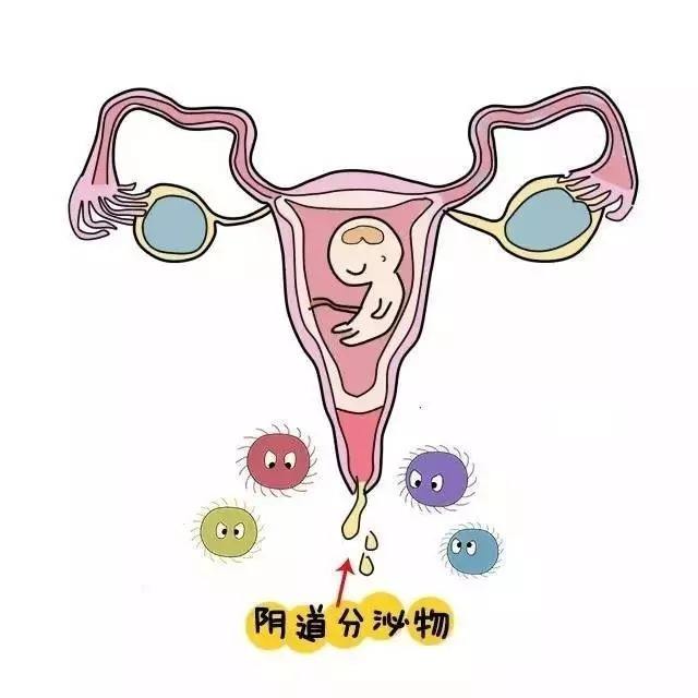 婦科引產(chǎn)不當(dāng)會(huì)導(dǎo)致哪些危害